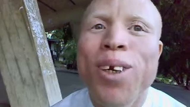 Albinos murders reach worrying level смотреть онлайн