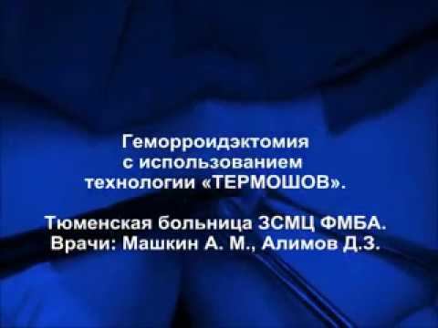Геморроидэктомия с использованием технологии "ТЕРМОШОВ" 1
