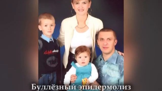 Ролик Особые дети смотреть онлайн