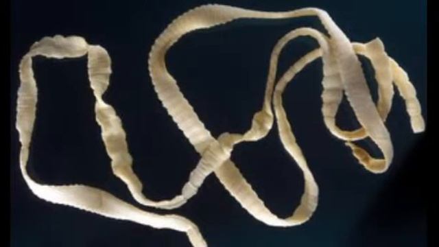 പനന ഇറചച കഴകകനനത അപകടമ? Pork meat problems