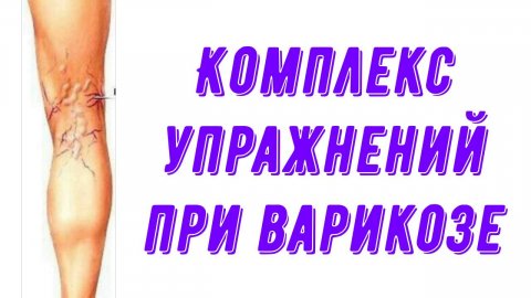 Комплекс упражнений при варикозе.