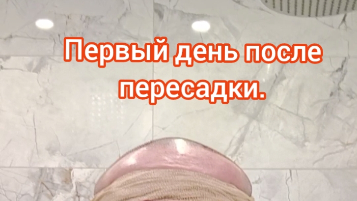 Первый день после пересадки волос. Пересадка волос в Питере.