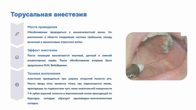 Анестезия.