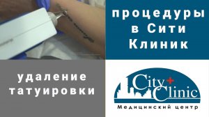 Лазерное удаление татуировок