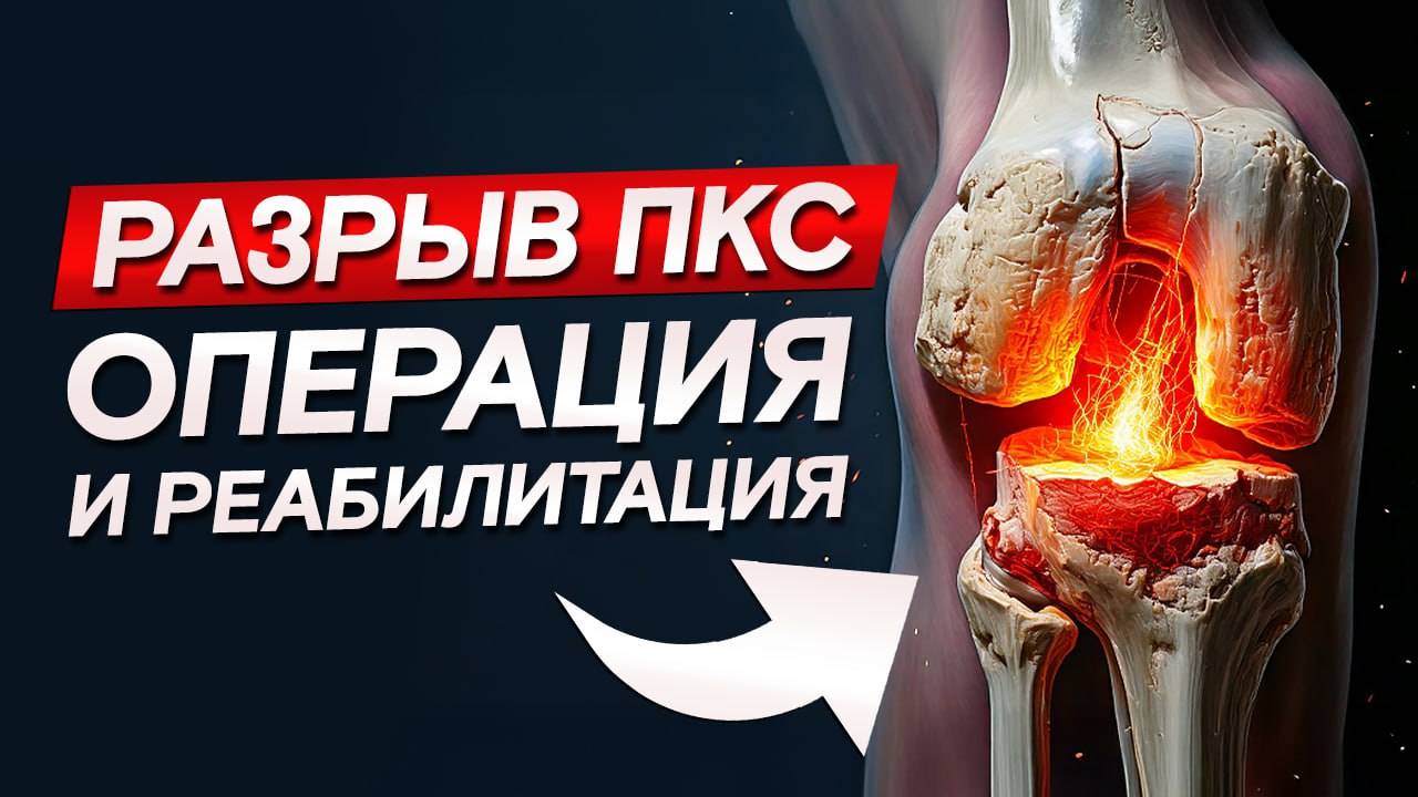 От травмы до восстановления: Операция на колене и реабилитация