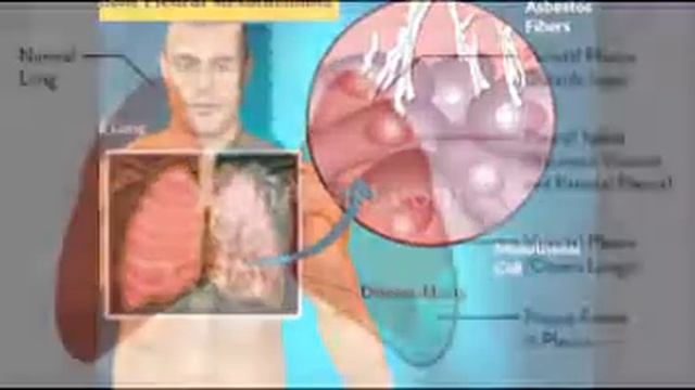 donate your car sacramento смотреть онлайн