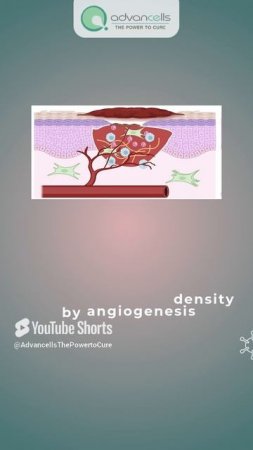 How stem cells accelerate wound healing?