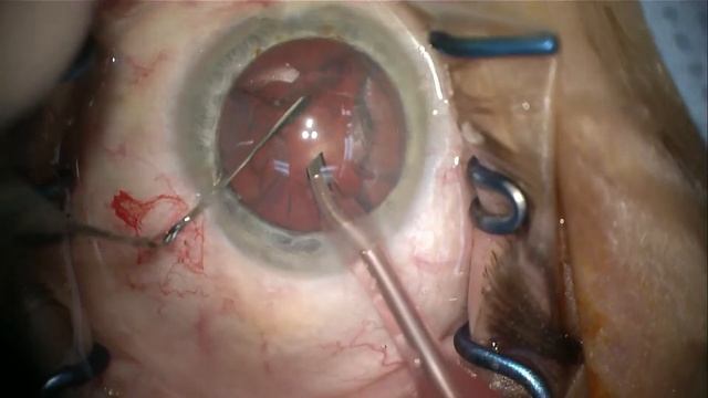 IOL 2018 смотреть онлайн