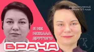 Пластическая операция по омоложению лица в 45 лет с короткой реабилитацией