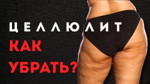 Лучший способ БЫСТРО избавиться от ЦЕЛЛЮЛИТА