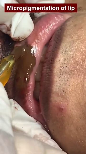Micropigmentation of lip Treatment | Viral #shorts