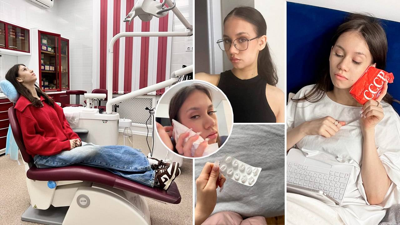 СНИМАЮ свой ДЕНЬ после УДАЛЕНИЯ ЗУБА 🦷 перед ПОЕЗДКОЙ с КЛАССОМ 🥳