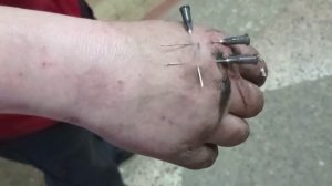 разлетелся молоток, попали осколки в руку.