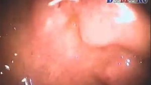 соль и перец