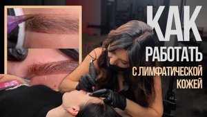 Как работать с лимфатической кожей?