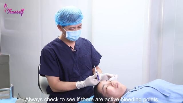 Trueself PLLA dermal filler for temple
