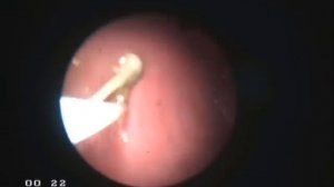 удаление инородного тела из желудка у кошки Фильм_0003.wmv