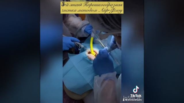 Поэтапная профессиональная гигиена полости рта.