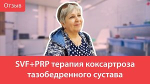 SVF+PRP терапия коксартроза тазобедренного сустава