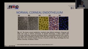AIOC2024 - GP142 - EyeShala 2024 - Session 1