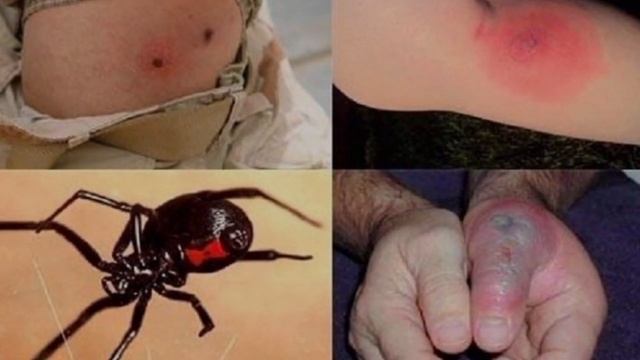 Самый ядовытый паук Чёрная вдова насикомые#паук #Чернаявдова #насикомые смотреть онлайн