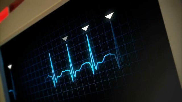 Top 10 Wearable Health Technologies For A Connected Lifestyle | Smartwatches & Health Trackers
