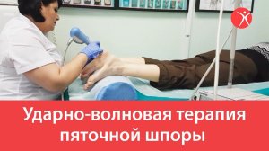 Лечение пяточной шпоры на аппарате ударно-волновой терапией