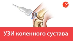 УЗИ коленного сустава