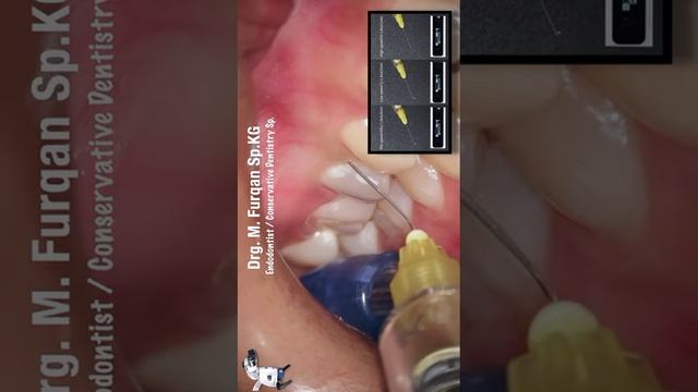 SOGA SMART II BY DR @furqanrizal6737 смотреть онлайн