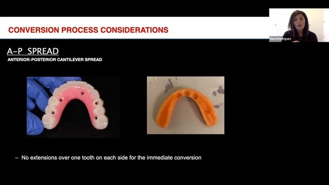 On-Demand Webinar: Denture Conversions: Analog to Digital Workflow (Part 1 of 3 Parts)