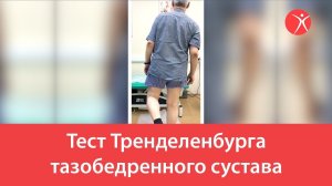 Тест Тренделенбурга тазобедренного сустава