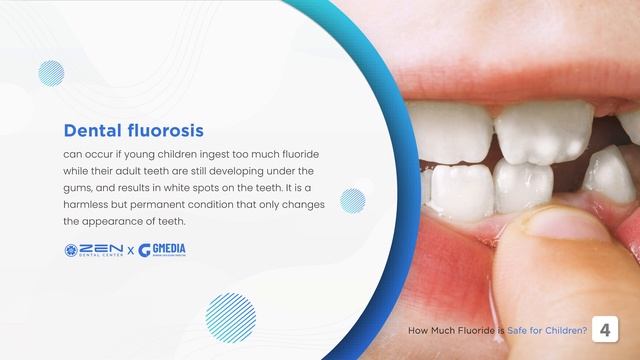 Zen Dental Storytelling: How Much Fluoride is Safe for Children?