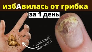 ГРИБОК НОГТЕЙ убрала за 15 минут обычной смесью, каждый найдёт дома.