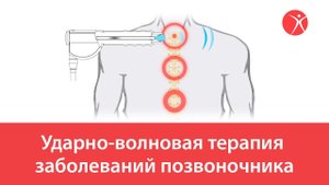 Ударно-волновая терапия заболеваний позвоночника