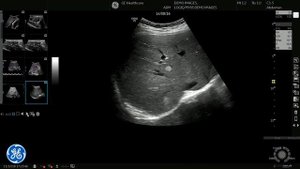 LOGIQ P9 – Conclusion (Greek Version) | GE Healthcare