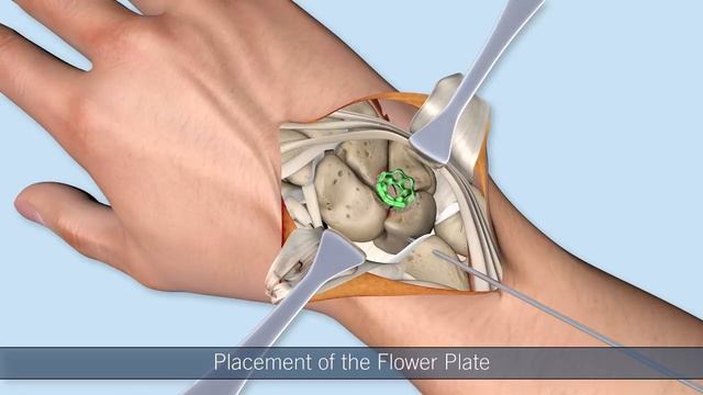FlowerPlate by KLS Martin – Four corner fusion смотреть онлайн