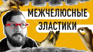 МЕЖЧЕЛЮСТНЫЕ ЭЛАСТИКИ