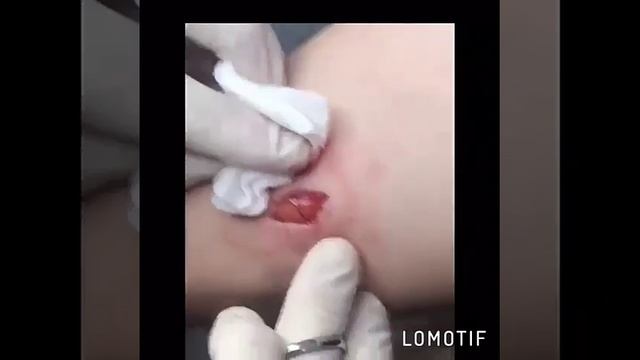 Медицинский процедурный кабинет. смотреть онлайн