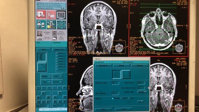 Ge mri reformat