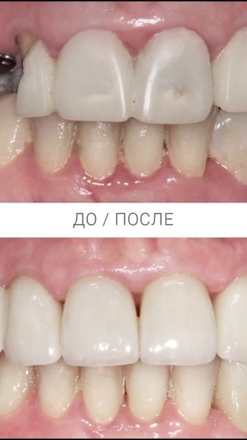 Красивая улыбка стала реальностью с помощью клиники «Юдента».