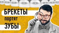 Портят ли брекеты зубы? Ortodony