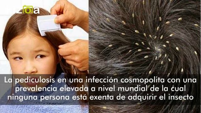 Kizoa Editar Videos - Movie Maker: piojos смотреть онлайн