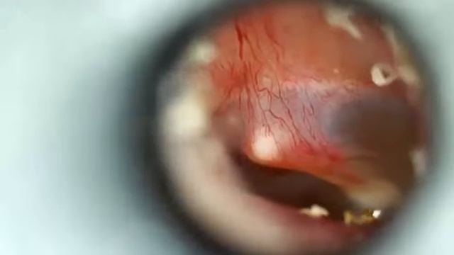 OTOSCOPE from ABELTECH смотреть онлайн