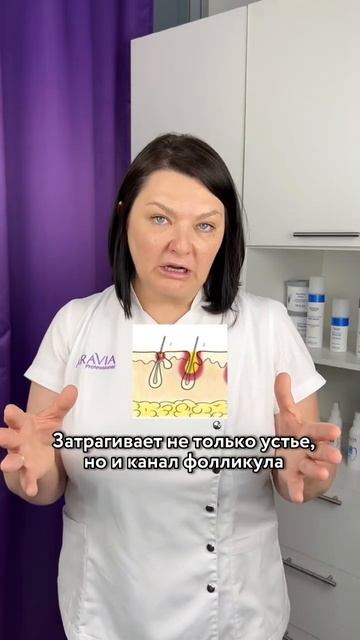 Страшный сон мастера по депиляции - фолликулит и остиофолликулит😱 смотреть онлайн