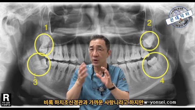 어떤 사랑니는 꼭 뽑아야 하고, 어떤 사랑니는 뽑지 않아도 되는걸까? 사랑니 발치의 적응증