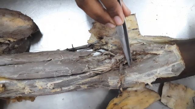 Cubital fossa - it's boundaries contents and applied aspects смотреть онлайн