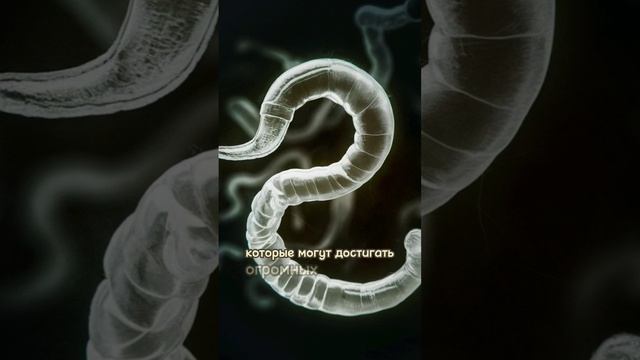 Топ 7 паразитов человека #Здоровье #Health #Паразиты #Parasites #Профилактика #Prevention смотреть онлайн