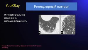 Глоссарий Флейшнеровского общества 2024 - Часть 3 Паттерны