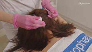 Hair X - мезотерапия волосистой части головы