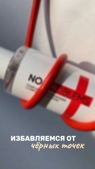 Избавляемся от черных точек!